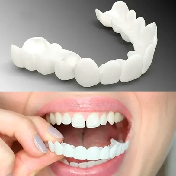 Lente Dental SmilePro [COMO PORCELANA]